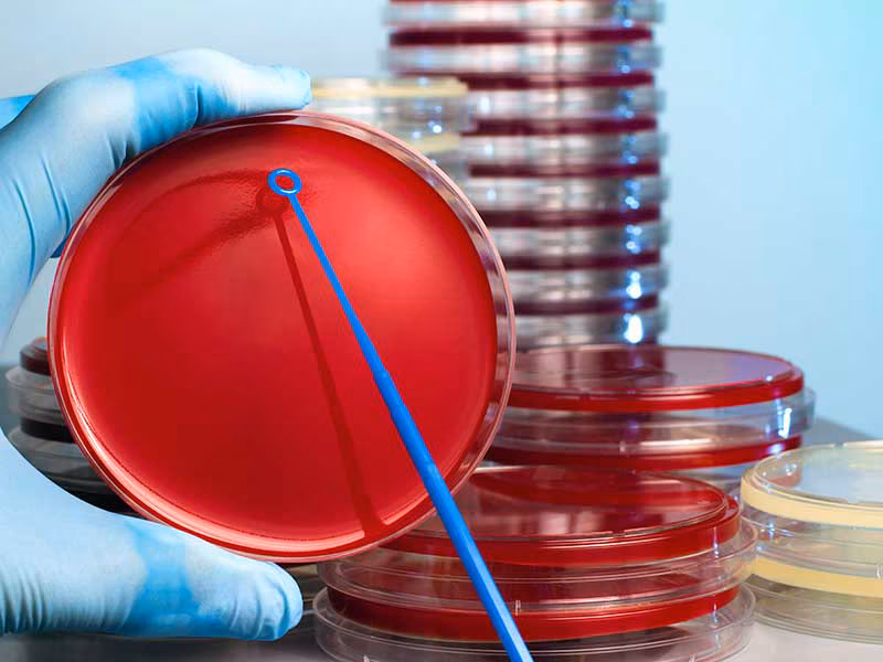 MICROBIOLOGY