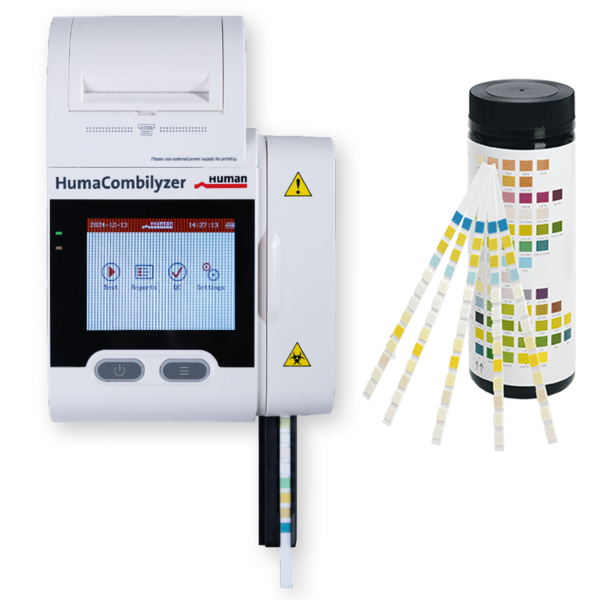 urinalysis